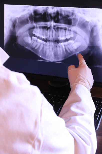 Best Emergency Dentist for Knocked-Out Tooth in Hagerstown, MD